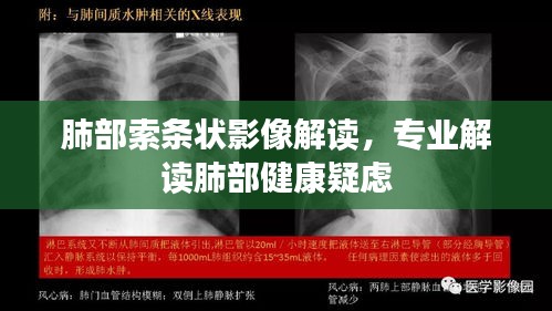 肺部索条状影像解读，专业解读肺部健康疑虑