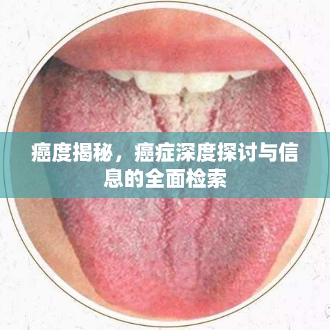 癌度揭秘，癌症深度探讨与信息的全面检索