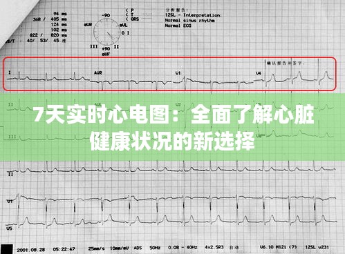 7天实时心电图：全面了解心脏健康状况的新选择