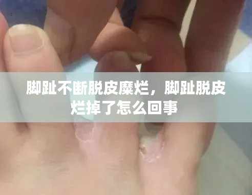 脚趾不断脱皮糜烂，脚趾脱皮烂掉了怎么回事 