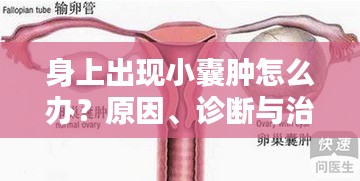 身上出现小囊肿怎么办？原因、诊断与治疗方法全解析