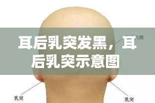 耳后乳突发黑，耳后乳突示意图 