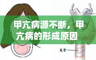 甲亢病源不断，甲亢病的形成原因 