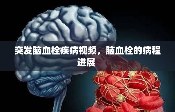 突发脑血栓疾病视频，脑血栓的病程进展 