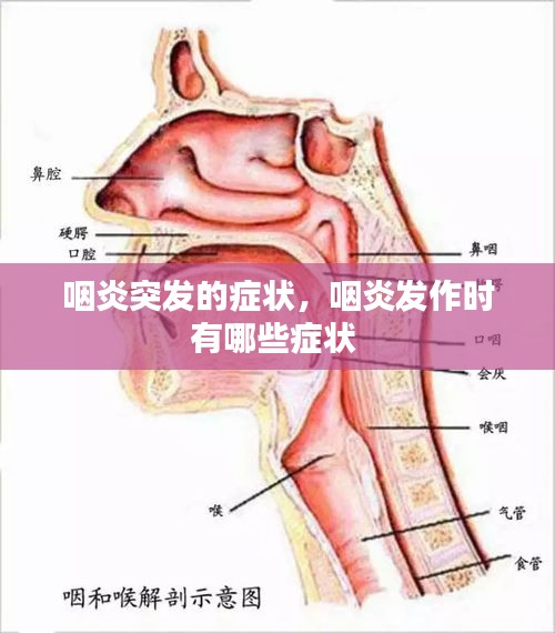 咽炎突发的症状，咽炎发作时有哪些症状 