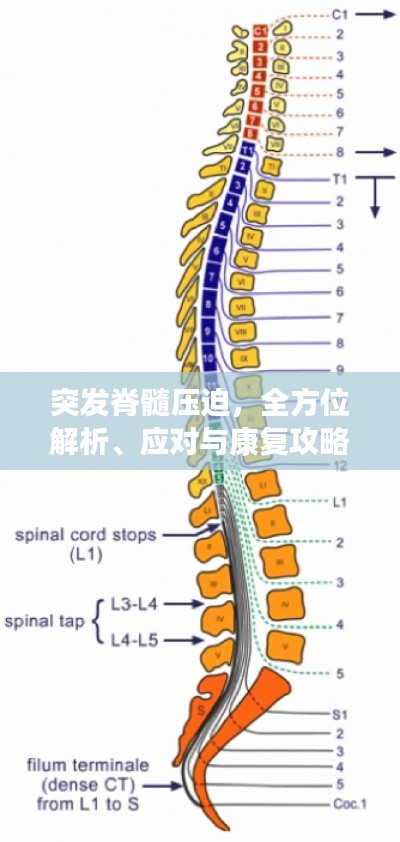 突发脊髓压迫，全方位解析、应对与康复攻略