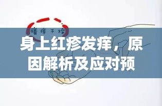 身上红疹发痒，原因解析及应对预防策略