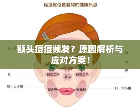 额头痘痘频发？原因解析与应对方案！