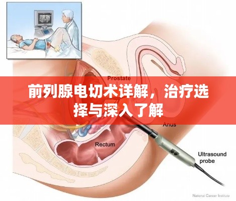 前列腺电切术详解，治疗选择与深入了解