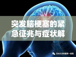 突发脑梗塞的紧急征兆与症状解析