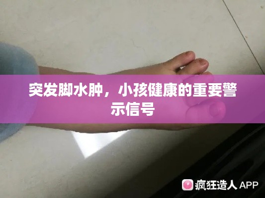 突发脚水肿，小孩健康的重要警示信号