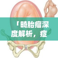 「畸胎瘤深度解析，症状、原因与治疗方法，百度为您解答！」