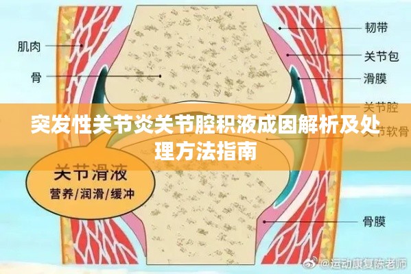 突发性关节炎关节腔积液成因解析及处理方法指南