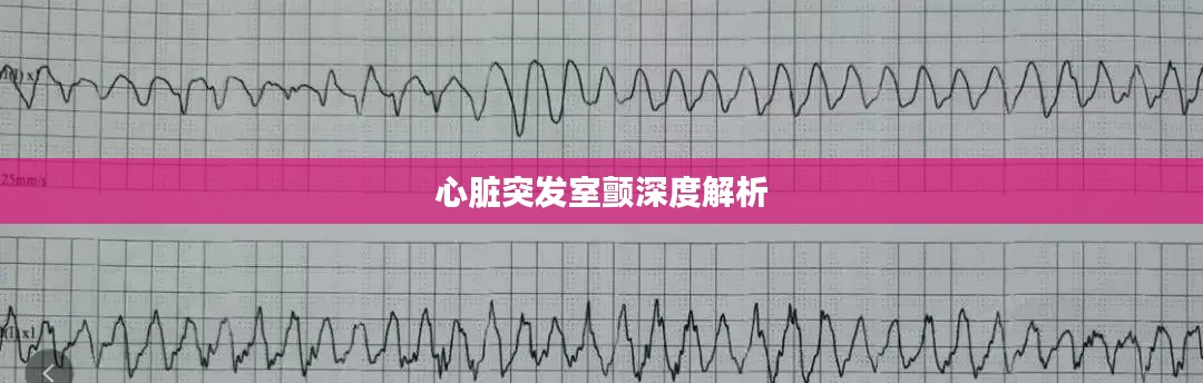 心脏突发室颤深度解析